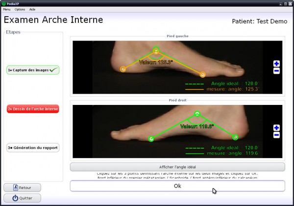 Nouveau matériel d'analyse  PodiaXP  Podologue meigneux  Pédicure